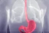 image of esophagus and stomach anatomy