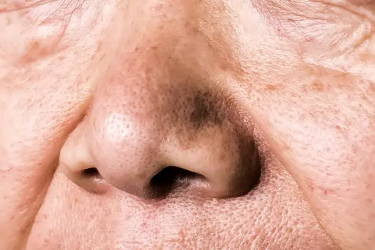 photo of senior woman's nose close up
