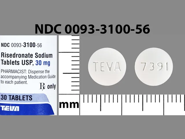 Risedronate (Actonel, Atelvia) TEVA 7391 Pill Image