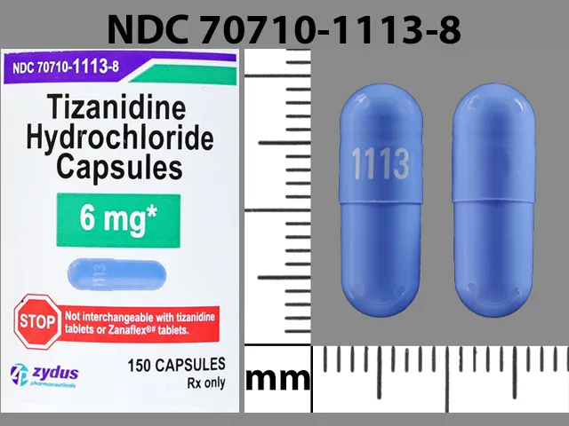 Tizanidine (Zanaflex) 1113 Pill Image
