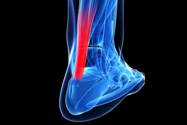 Your Achilles tendon in the biggest, strongest tendon in your body. If you injure it, it often heals on its own, but it will take time. (Photo credit: Sebastian Kaulitzki/Dreamstime)