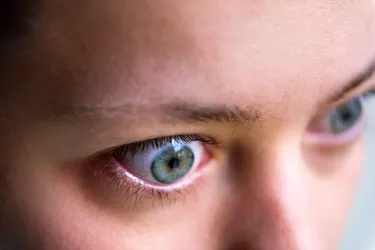 An injury, infection, or condition such as thyroid eye disease can cause bulging eyes. (Photo Credit: iStock/Getty Images)