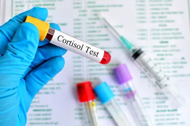 A cortisol test can diagnose a number of problems in your pituitary or adrenal glands. (Photo credit: Jarun011/Dreamstime)