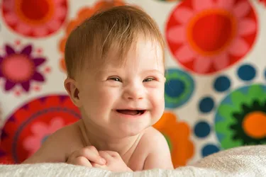 While Down syndrome affects people both physically and mentally, it’s very different for each person. And there’s no telling early on what its impacts will be. No matter what symptoms a person with Down syndrome has, early treatment is key. (Photo credit: Eleonoraos/Dreamstime)
