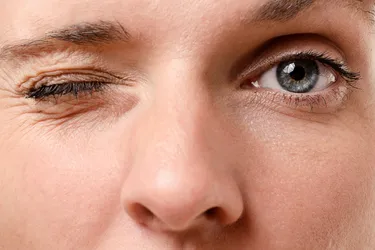 An eye twitch is an eye muscle or eyelid spasm or movement that you can't control. A minor eyelid twitch is often linked to everyday things like fatigue, stress, or caffeine. (Photo credit: iStock/Getty Images)