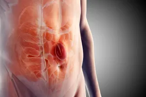 If you have a hernia, it means an organ or fatty tissue pushed through your muscle or connective tissue. They usually happen in your belly or groin. (Photo Credit: Science Picture Co/Science Source)