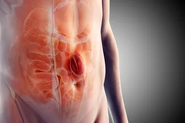 If you have a hernia, it means an organ or fatty tissue pushed through your muscle or connective tissue. They usually happen in your belly or groin. (Photo Credit: Science Picture Co/Science Source)