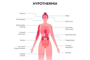 Some of the symptoms of hypothermia are shivering, tiredness, and loss of memory. (Photo credit: iStock/Getty Images)