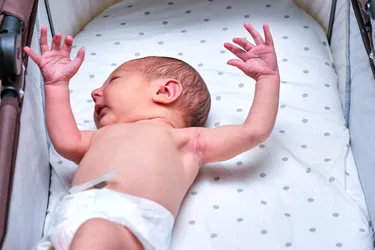 The Moro reflex is a typical development milestone in newborn babies that lasts anywhere from 2 to 6 months. Premature babies or those with certain neurological conditions may have this so-called startle reflex longer. (Photo Credit: iStock/Getty Images)