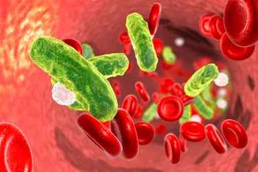 Sepsis is usually caused by bacteria, but it can also be caused by viruses and fungi. 