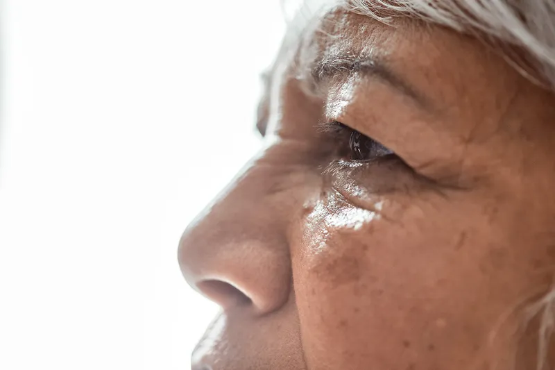 What Is Age-Related Macular Degeneration?