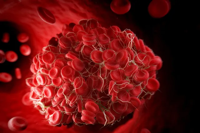 Understand the Dangers of High Cholesterol