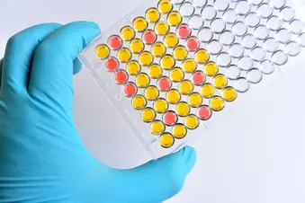 photo of immunology testing