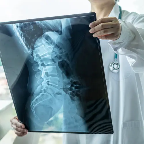 photo of doctor examining spinal X-ray