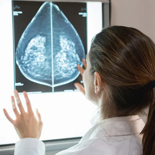 photo of doctor looking at mammogram