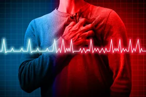 AFib occurs when your heartbeat is irregular or unusually fast. Photo credit: wildpixel/iStock/Getty Images