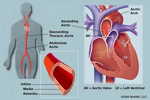 Your doctor often can diagnose a thoracic aortic aneurysm with tests such as an X-ray, an echocardiogram, CT scan, or ultrasound. 