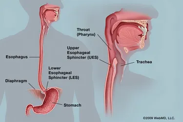 One of the most common types of esophagitis is called erosive, or reflux, esophagitis. It happens when the contents of your stomach back up into your esophagus, irritating it.