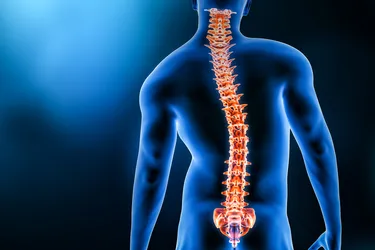 Scoliosis is a sideways curvature of the spine. (Photo credit: Matthieu Louis/iStock/Getty Images)