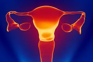 A Pap smear, also called a Pap test, is an exam a doctor uses to test for cervical cancer in women. It can also reveal changes in your cervical cells that may turn into cancer later.