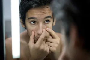 To understand acne, you need to know how your skin works.