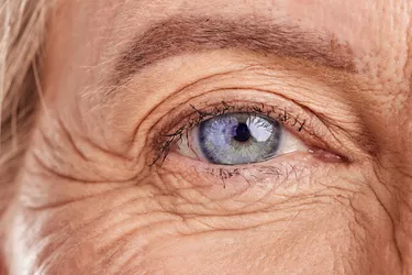 Wrinkles are a by-product of the aging process. Photo credit: Yuri Arcurs/Dreamstime