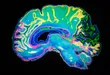 colorful brain image