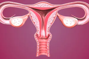 Tubal ligation is a permanent method of birth control that involves surgery to cut or block your fallopian tubes. Photo Credit: Getty Images