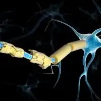 photo of damaged myelin sheath