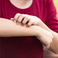 photo of woman scratching arm