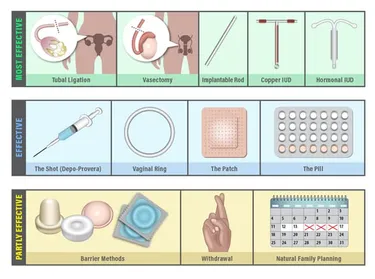 Which Types of Birth Control Work Best? Birth Control Effectiveness Chart