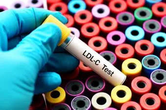 photo of ldl cholesterol test