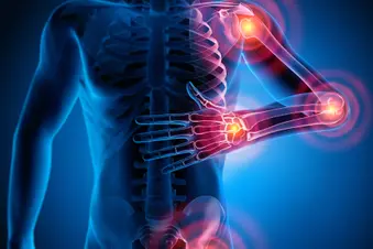 Managing Bad Days With Psoriatic Arthritis 2 photo of medical illustration torso pain joint bla