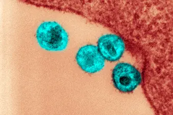 photo of HIV virus