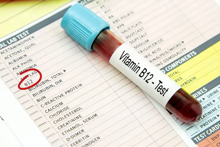 photo of vitamin b12 lab test