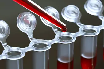 photo of blood tests