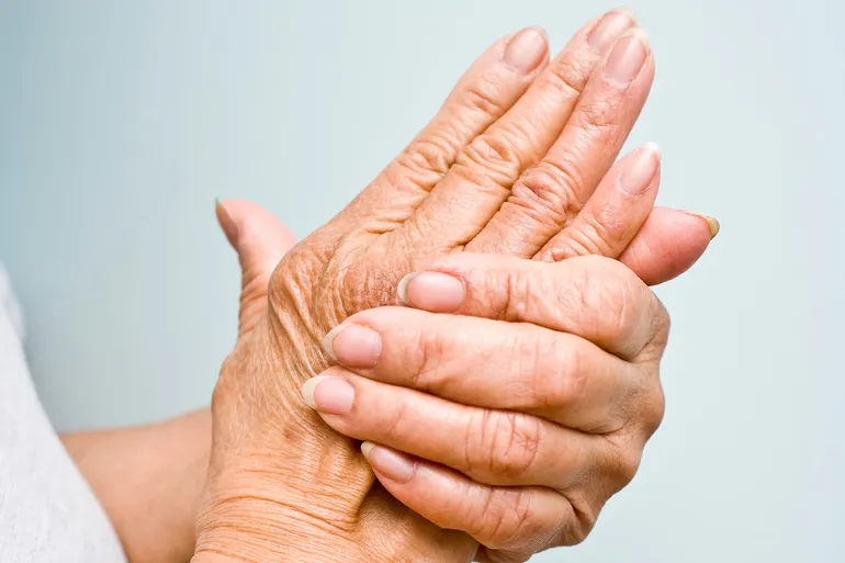 What Do You Know About Psoriatic Arthritis?