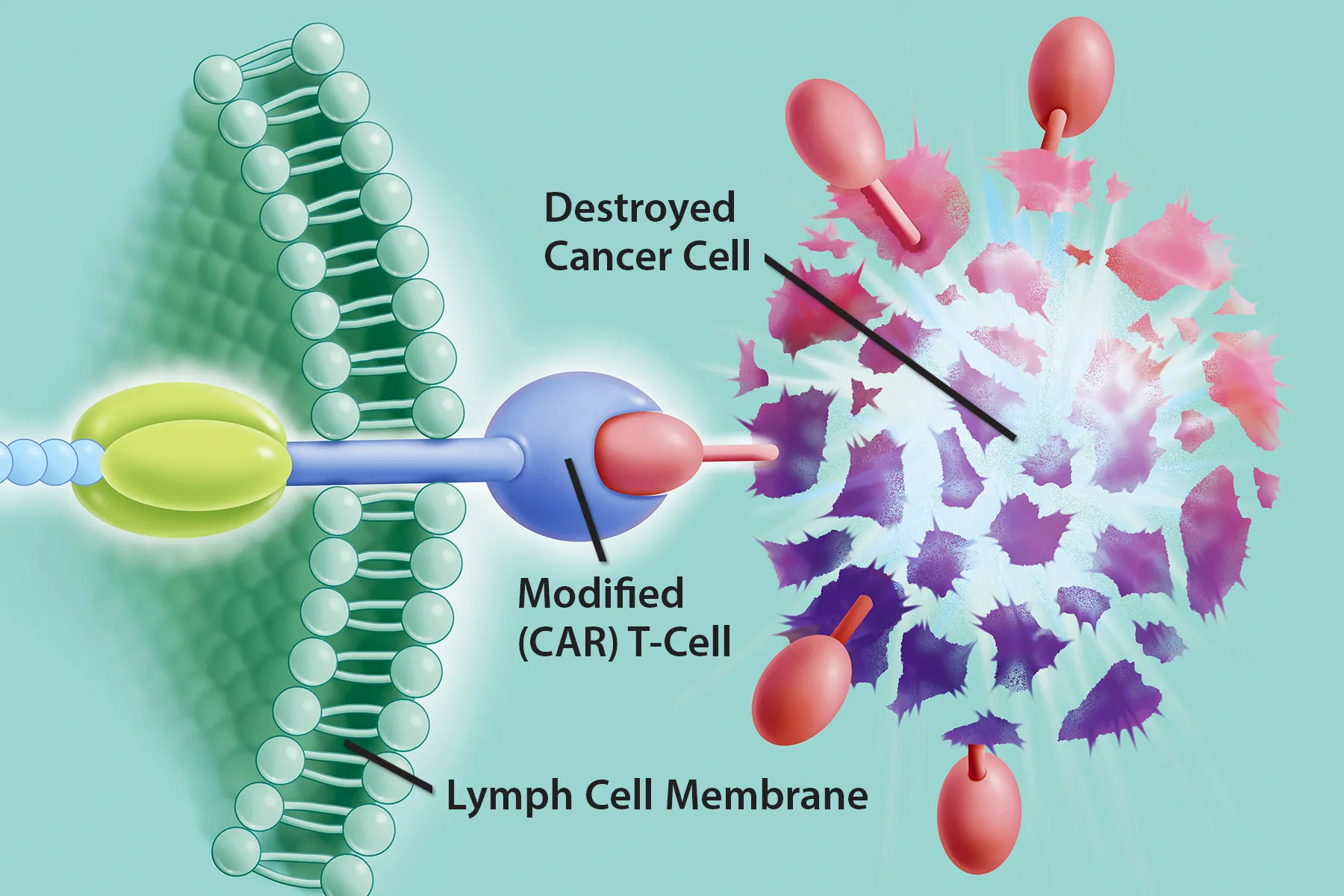 Car T Cell Therapy For Follicular Lymphoma 7653