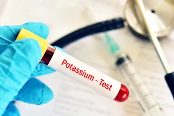 photo of potassium test