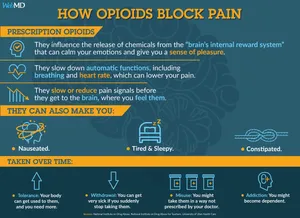 Before you take opioids, there are things you should understand about them.