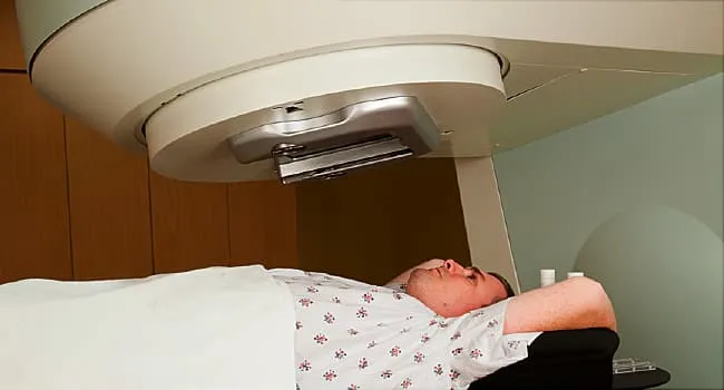 Radiation Therapy for Multiple Myeloma Treatment