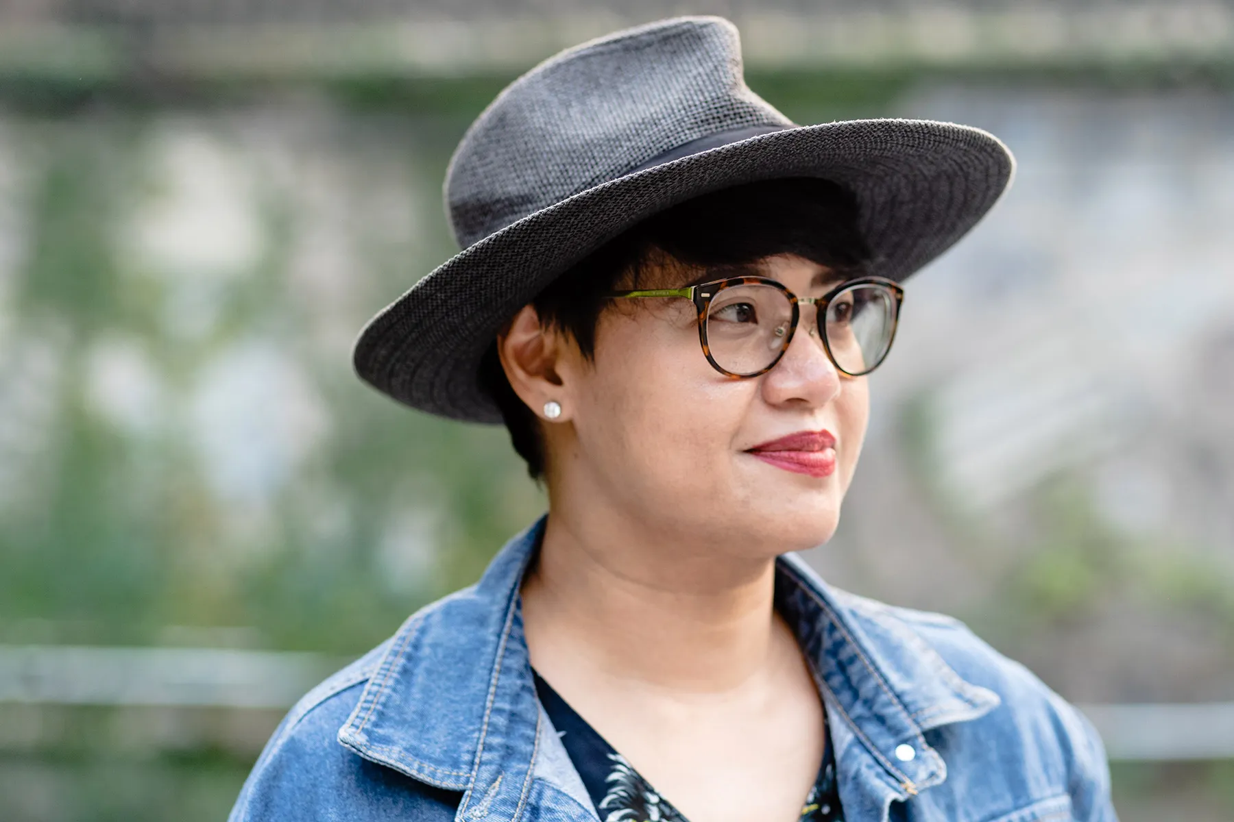 Alopecia Areata Caring for Your WellBeing