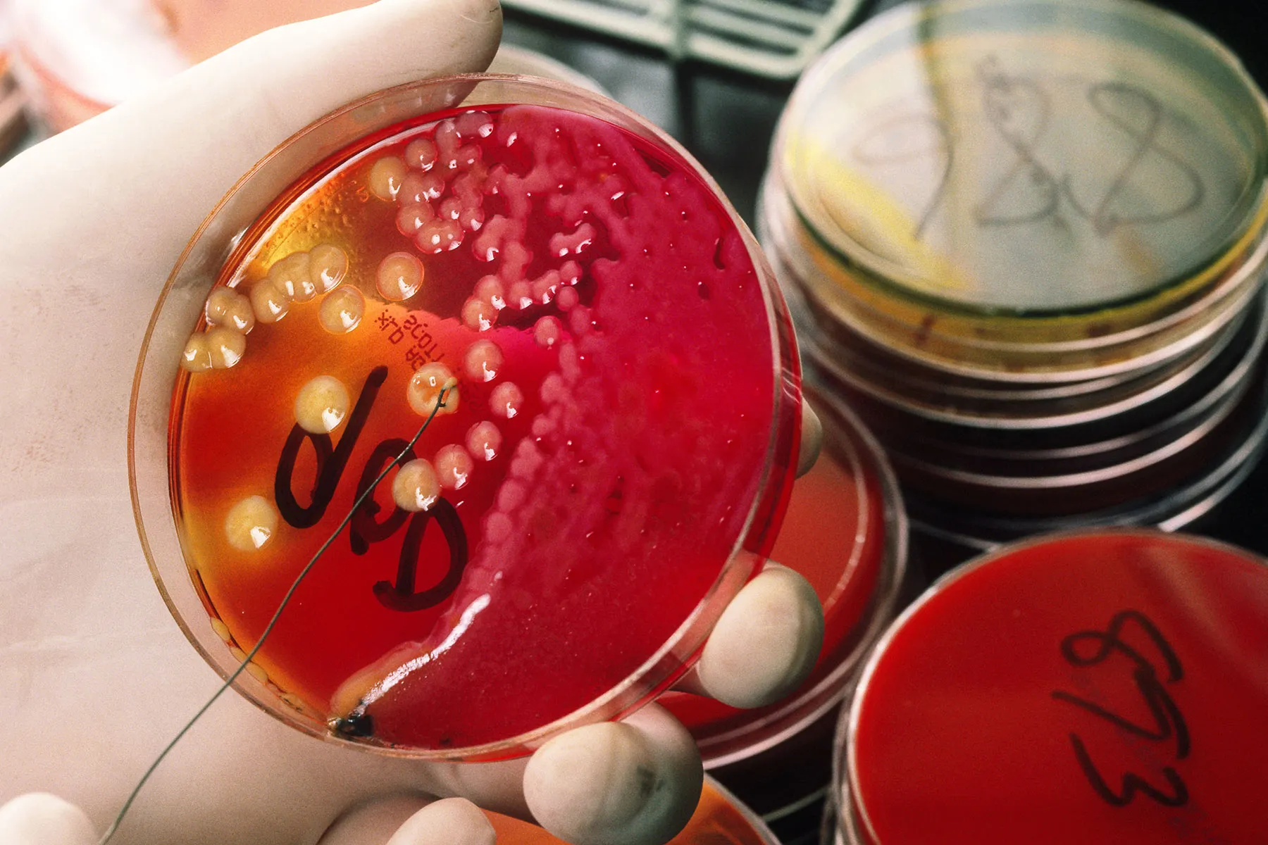 Gut Check The Real Reason You Avoid That AtHome Stool Test