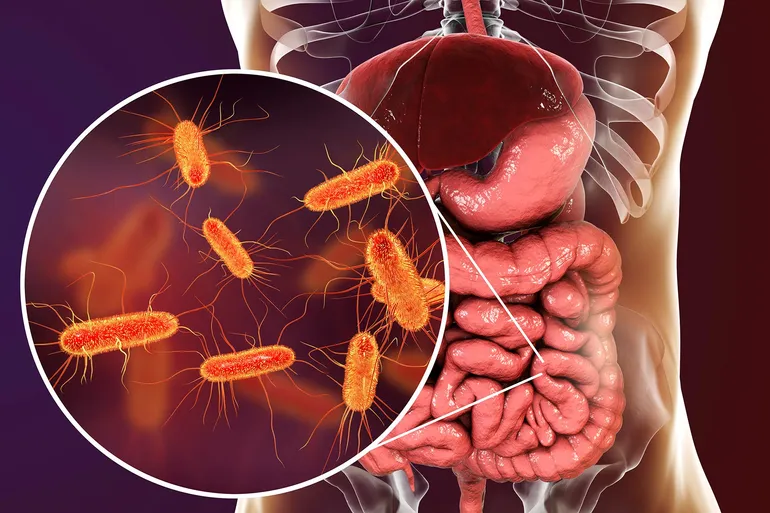 Best and Worst Foods for Gut Health