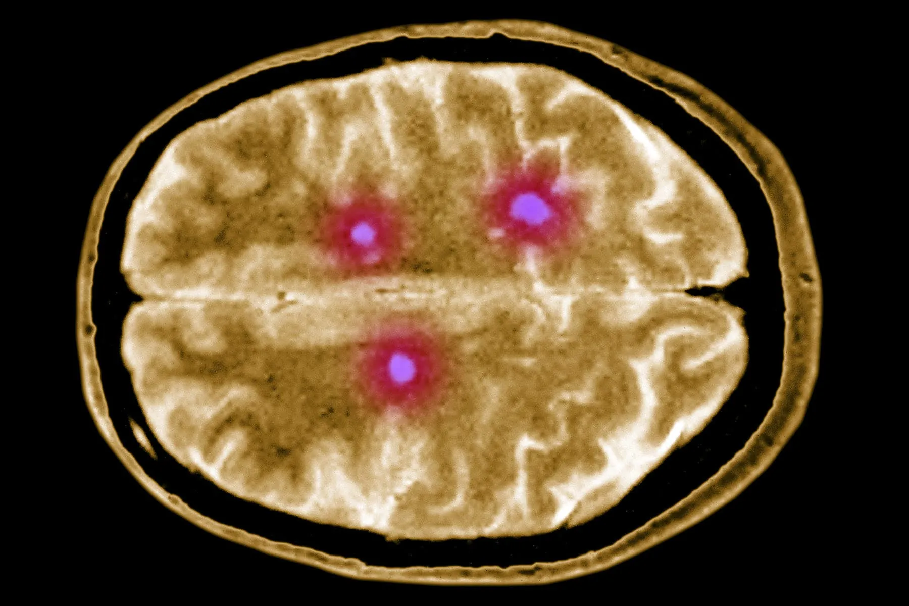 Conditions That Change the Brain