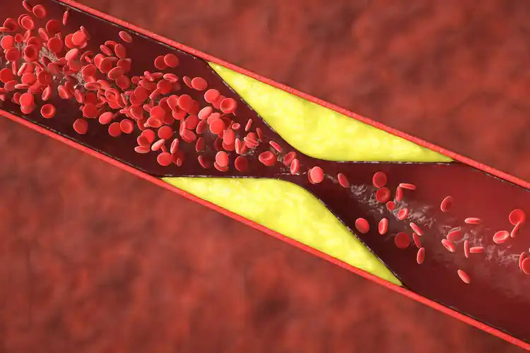 Myths and Facts: Cholesterol