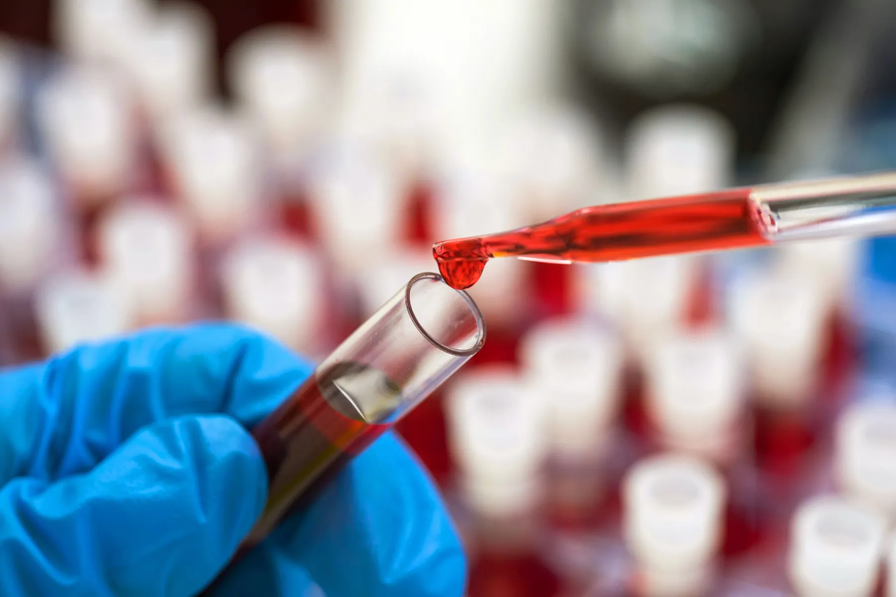 Monitoring chronic lymphocytic leukemia before treatment