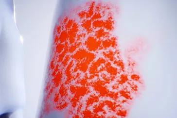 How Treatment Works