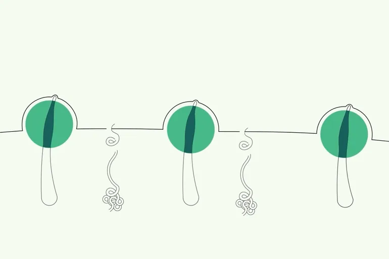A Look Inside Blocked Hair Follicles