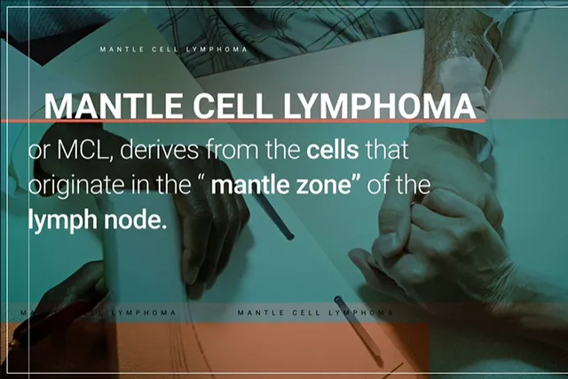 The Basics of Mantle Cell Lymphoma